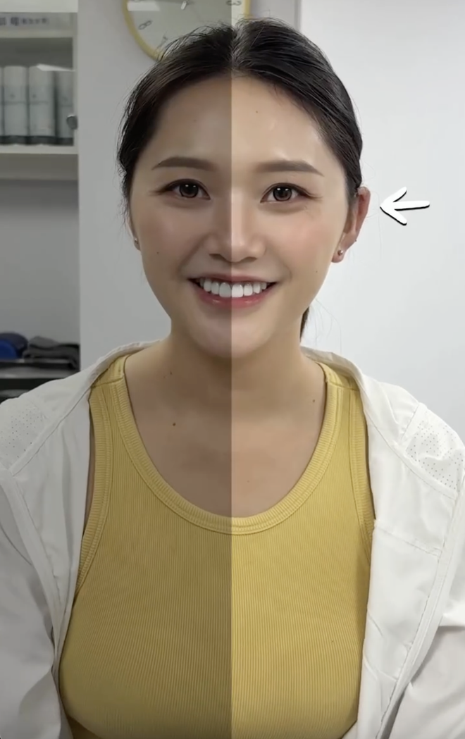 Cô gái khổ sở 30 năm vì tai giống Đoàn Di Băng- Ảnh 2.