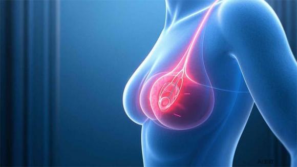 benh-di-truyen (1).jpg 4 di truyền, bệnh di truyền