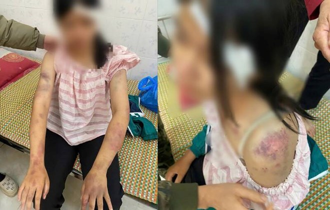 Bắt các đối tượng liên quan 3 Vụ bé gái 13 tuổi bị bà nội tra khảo, đánh đập dã man: Bắt các đối tượng liên quan - Ảnh 3.