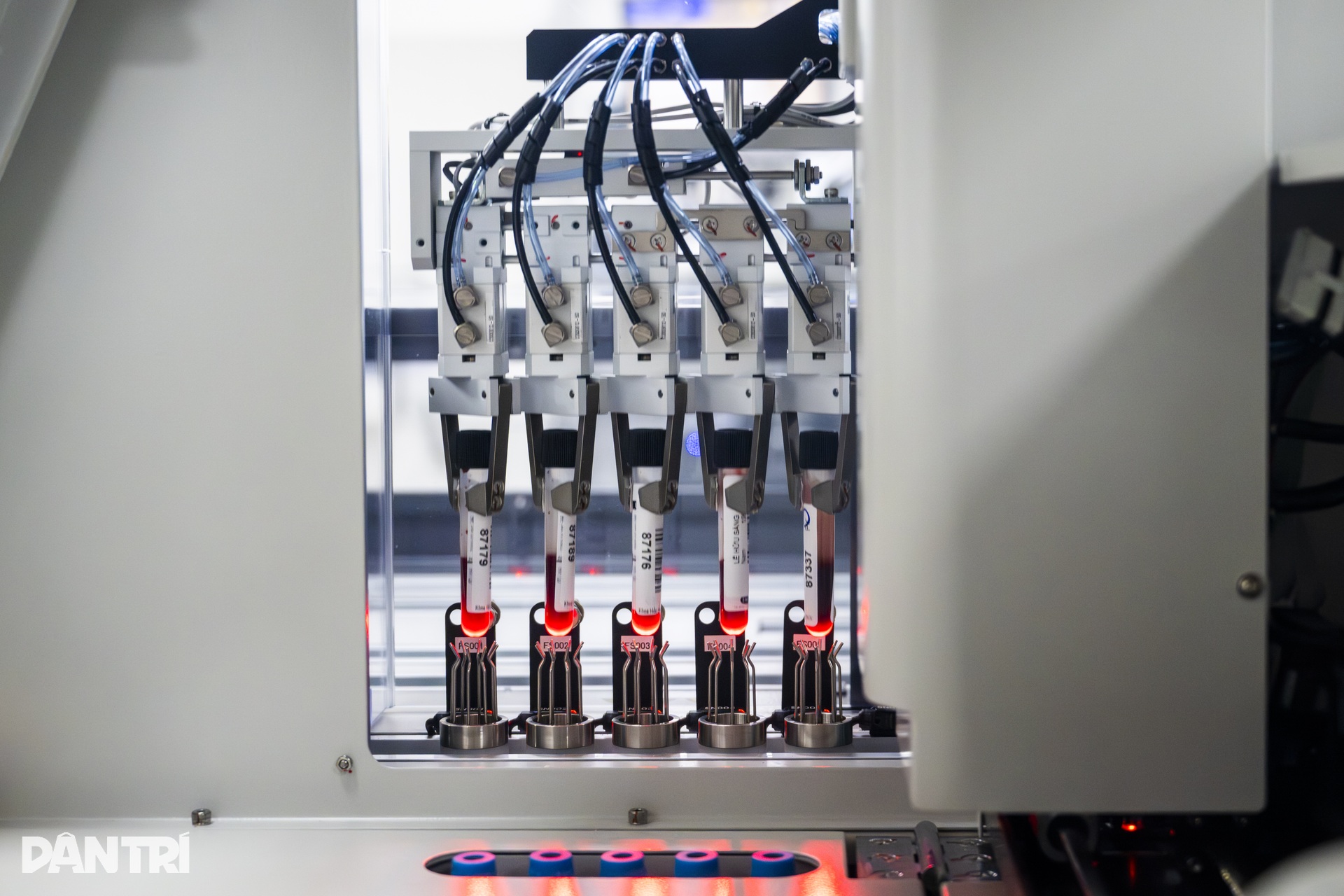 Hệ thống xét nghiệm máu tự động 20.000 mẫu/ngày hiện đại bậc nhất Việt Nam - 9