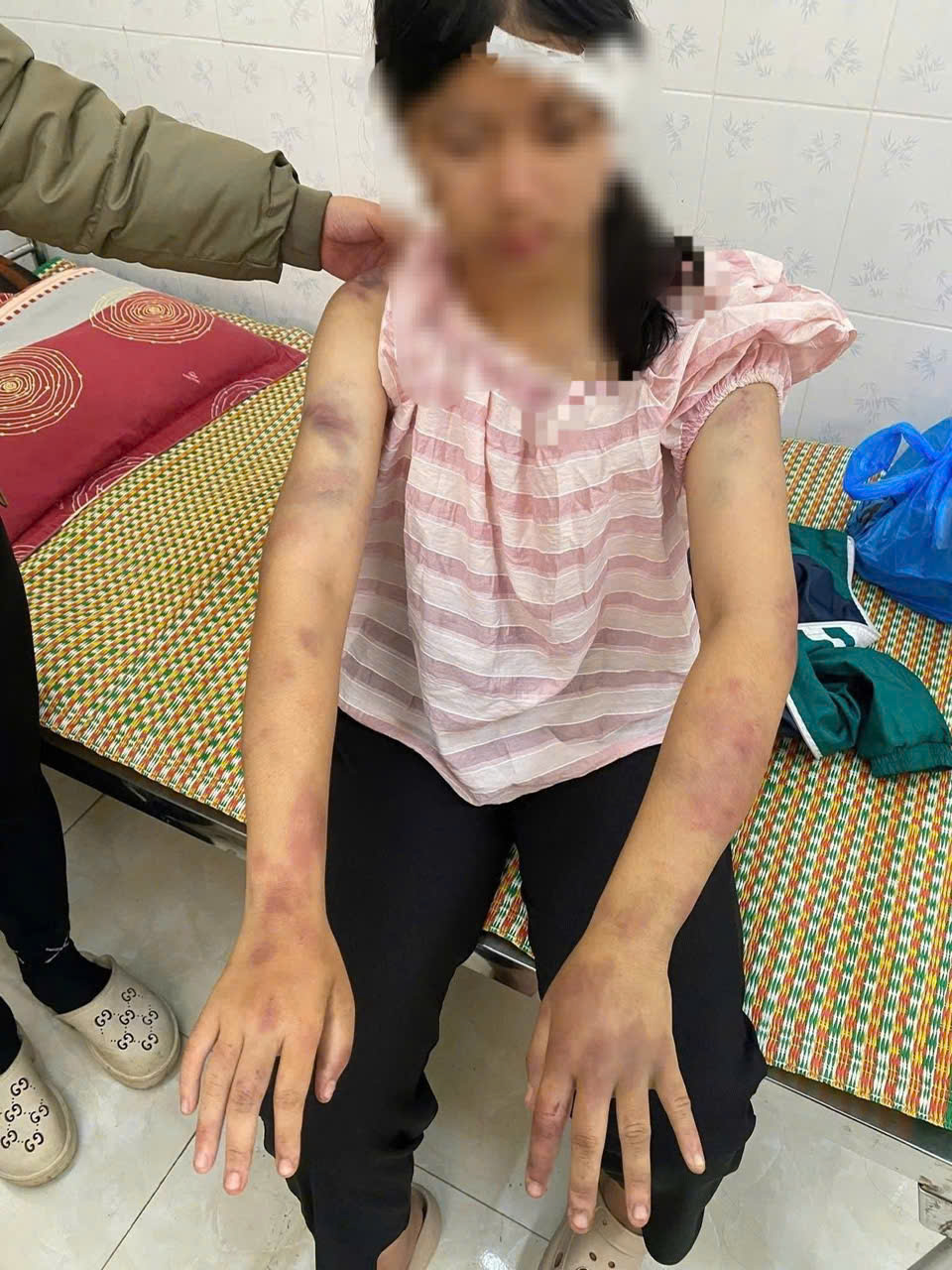 Cục Bà mẹ và Trẻ em chỉ đạo điều trị tâm lý cho bé gái bị 3 người thân bạo hành 4 Cục Bà mẹ và Trẻ em chỉ đạo điều trị tâm lý cho bé gái bị 3 người thân bạo hành - Ảnh 4.