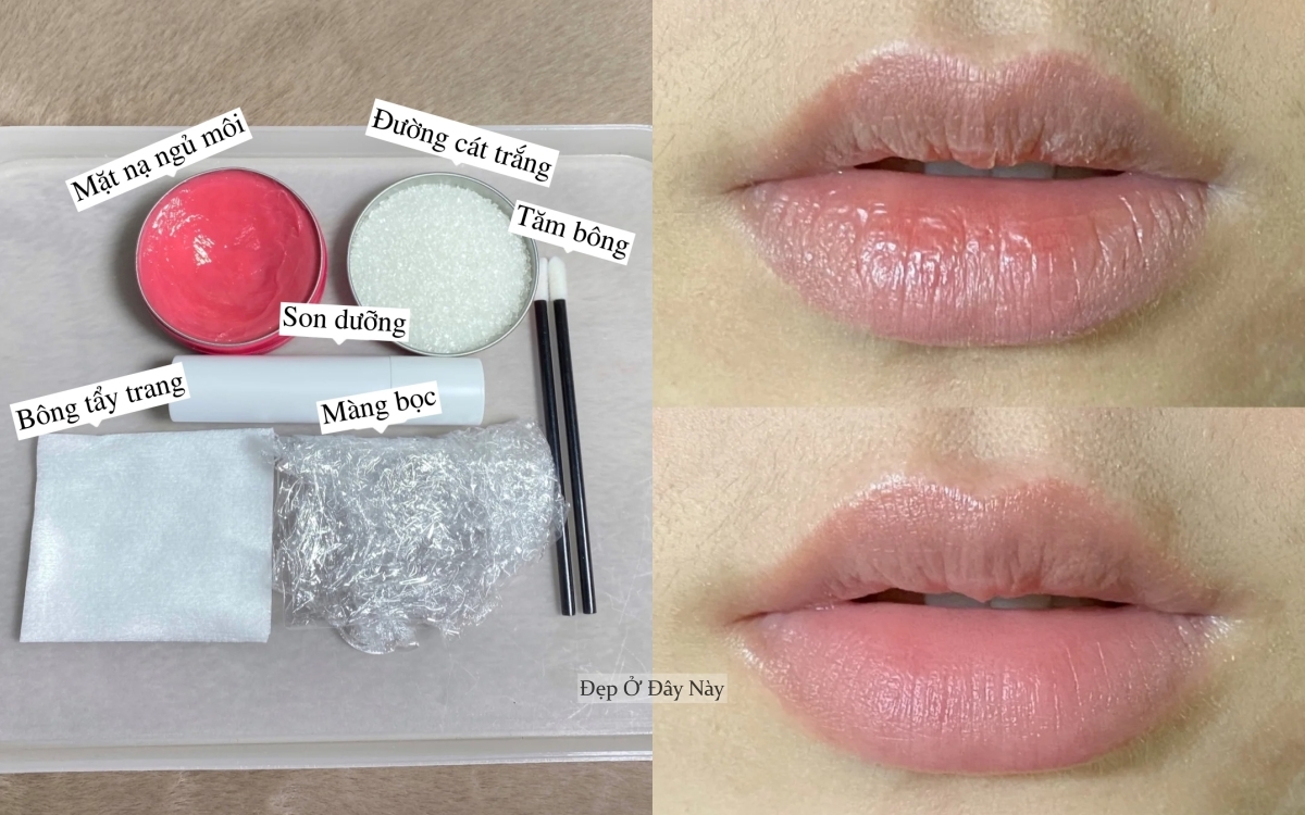 Chuyên viên thẩm mỹ viện 10 năm mách bạn mẹo trị môi khô tại nhà, rẻ mà hiệu quả bất ngờ 2 Chuyên viên thẩm mỹ viện 10 năm mách mẹo trị môi khô tại nhà, rẻ mà hiệu quả bất ngờ - Ảnh 2.