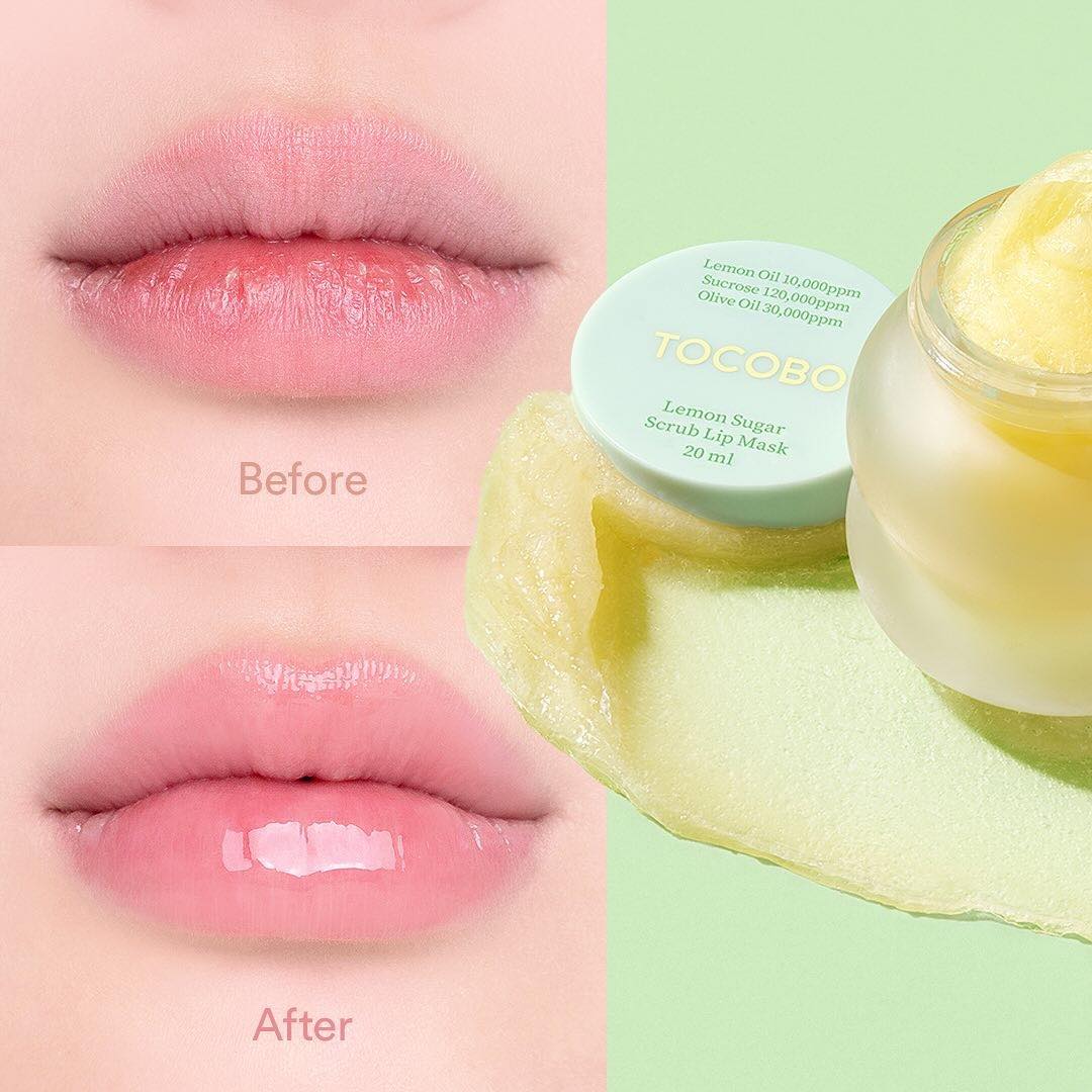 Chuyên viên thẩm mỹ viện 10 năm mách bạn mẹo trị môi khô tại nhà, rẻ mà hiệu quả bất ngờ 6 Chuyên viên thẩm mỹ viện 10 năm mách mẹo trị môi khô tại nhà, rẻ mà hiệu quả bất ngờ - Ảnh 6.