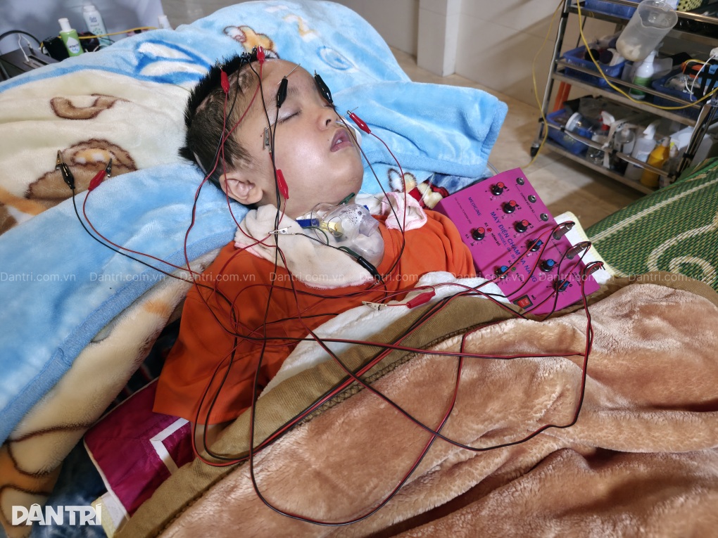 Con trai 8 tuổi thoi thóp sau tai nạn, bố mẹ kiệt sức níu giữ mạng sống - 3