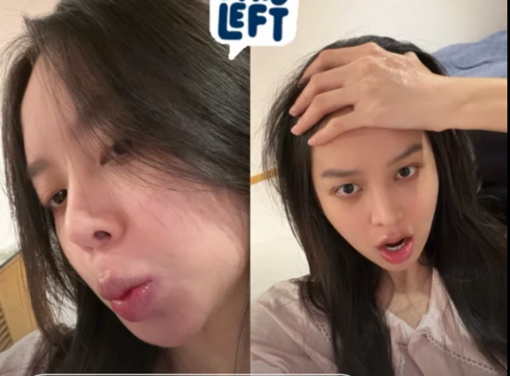 Sở hữu làn da mịn màng nhưng không khó để nhận thấy một khuyết điểm nhẹ trên gương mặt Thanh Thủy, đó chính là quầng thâm mắt. Nhiều người cho rằng, có lẽ do lịch trình bận rộn tại Nhật Bản nên nàng hậu trông có chút nhợt nhạt, mệt mỏi song nhìn tổng thể vẫn rất xinh đẹp.