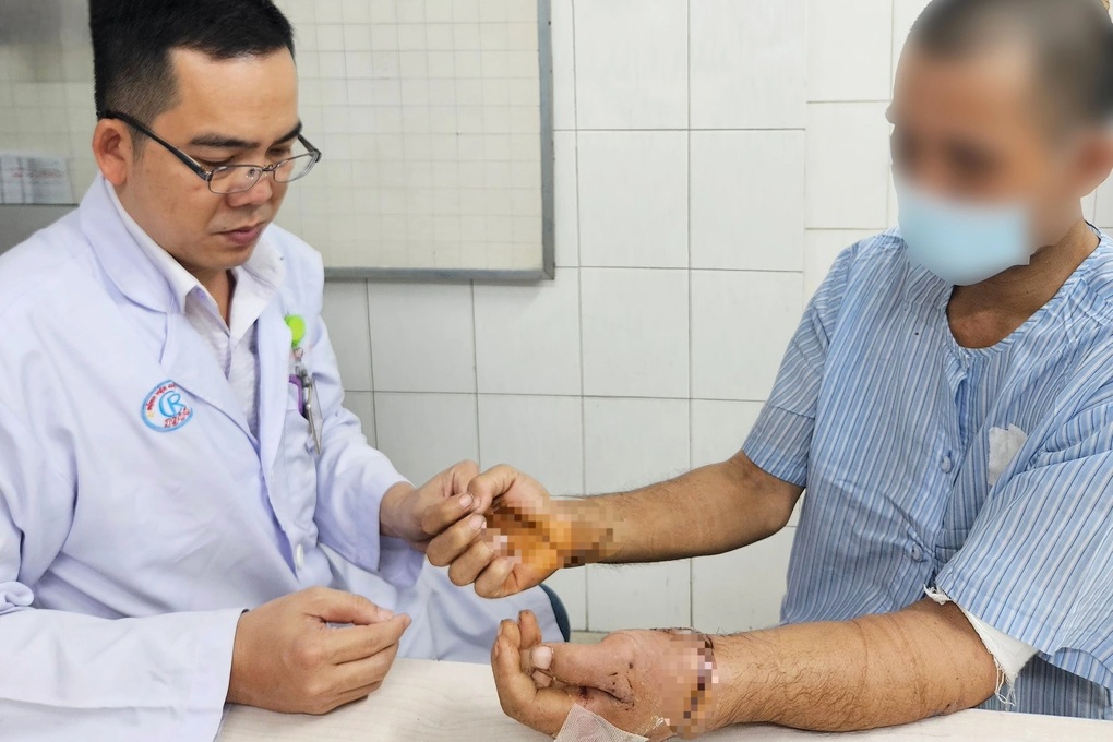 Ẩu đả với hàng xóm, người đàn ông 40 tuổi bị chém đứt cả 2 bàn tay - 1