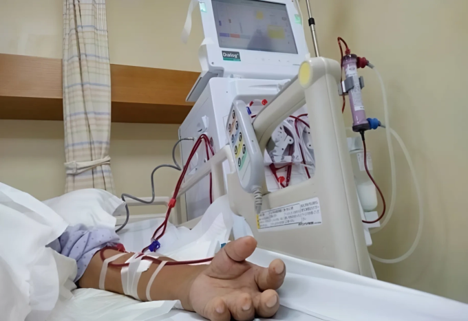 Một bệnh nhân đang chạy thận nhân tạo. Ảnh: Đinh Tiên
