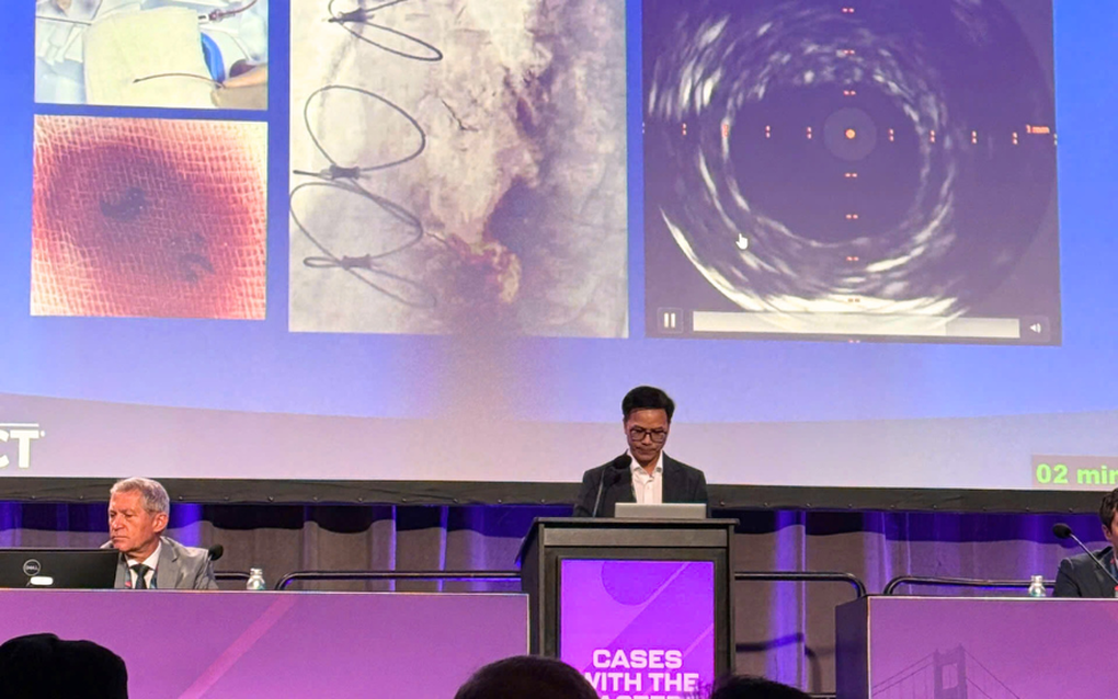 Bác sĩ Việt trình bày ca can thiệp tim mạch phức tạp tại hội nghị hàng đầu thế giới - 2