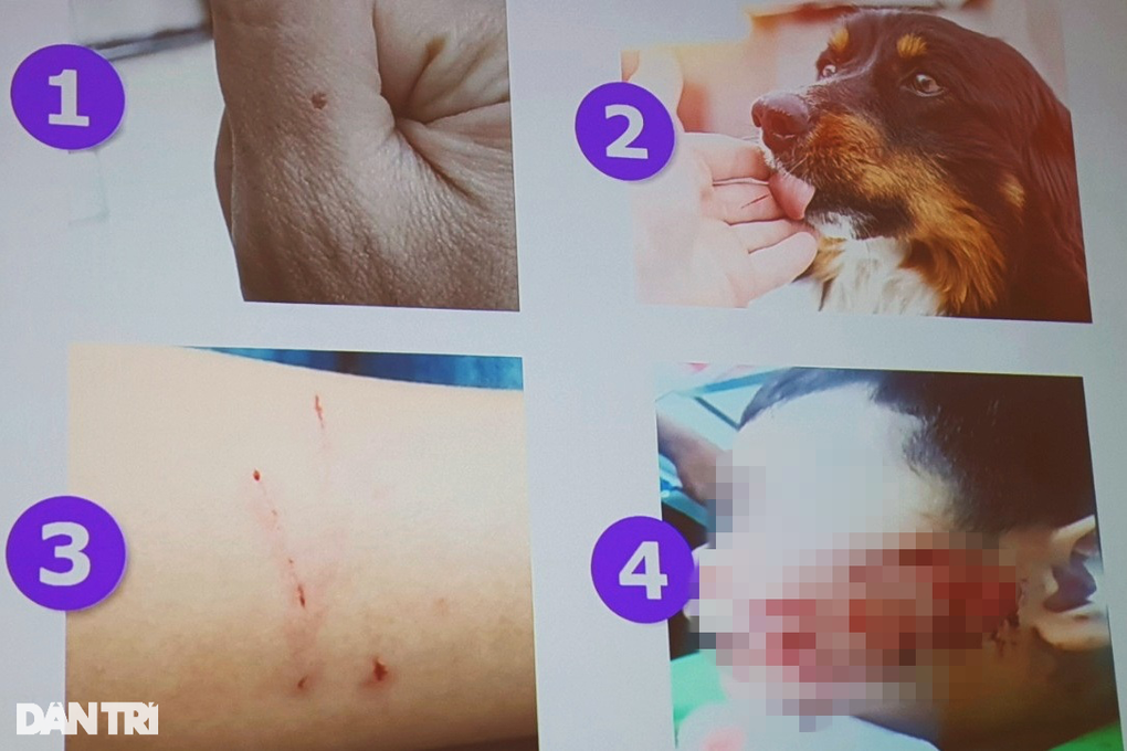 Bác sĩ cảnh báo loạt bệnh dễ bùng phát sau lũ - 3