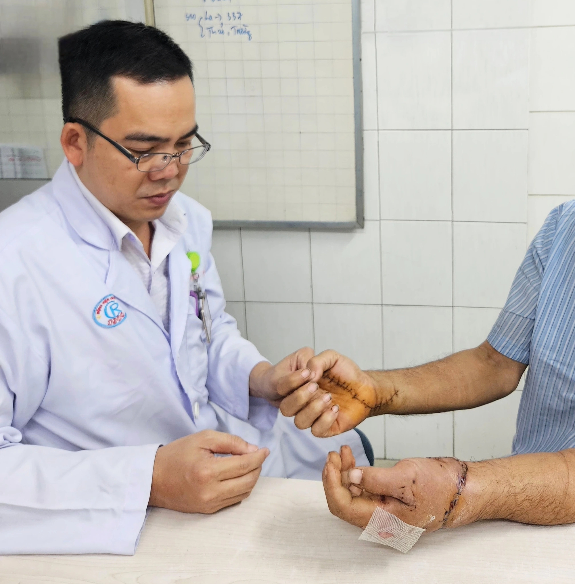 Bệnh viện Chợ Rẫy 'báo động đỏ’, 12 giờ nối 2 tay đứt lìa cho bệnh nhân- Ảnh 2.