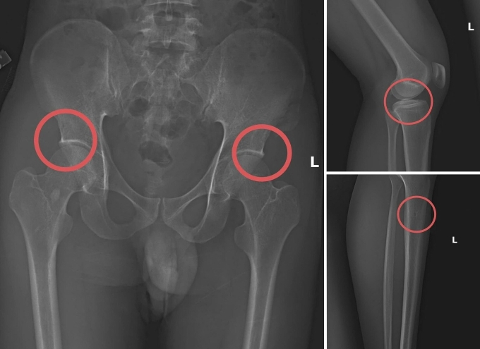 Các vết thương do Châu tự tạo nên. Ảnh: Công an cung cấp