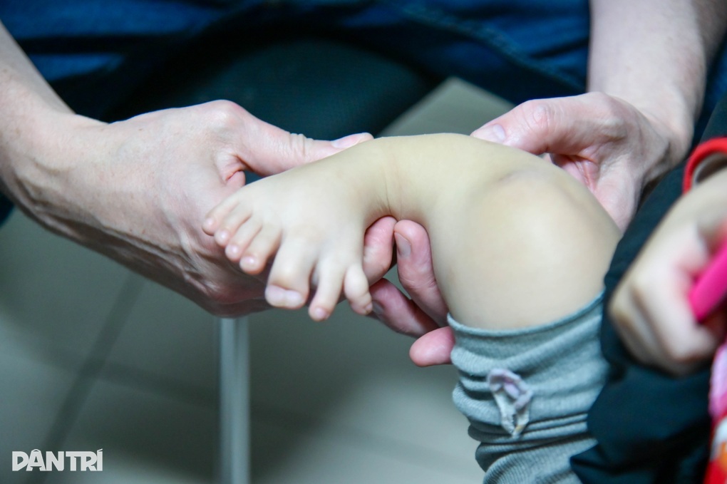 Căn bệnh hiếm ở trẻ gây khó vận động, mất nhiều năm điều trị - 1