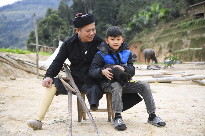 Nạn nhân bom mìn chiến tranh ở biên giới Vị Xuyên, Hà Giang cũ. Ảnh: Giang Huy