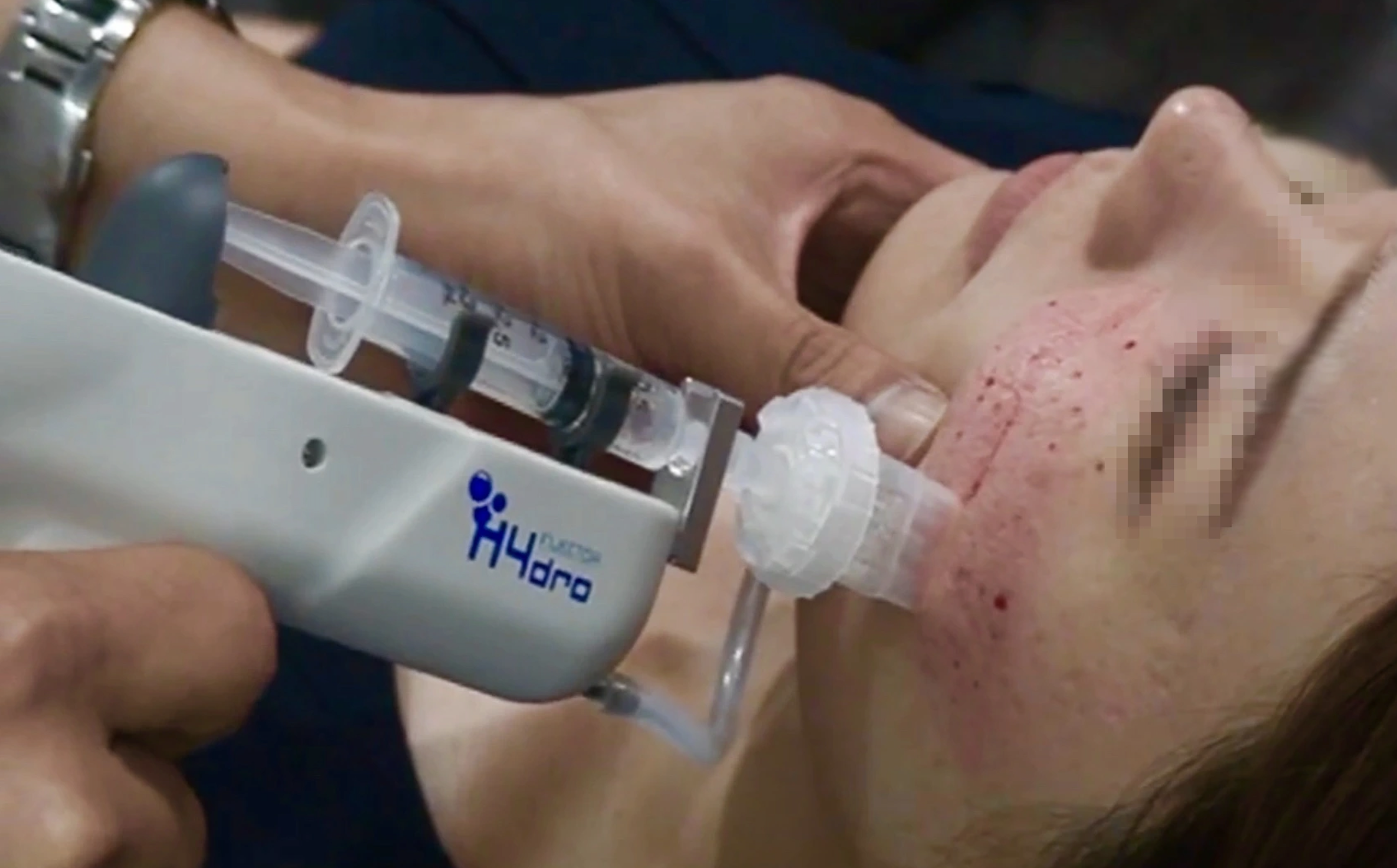 - Ảnh 2. - Ảnh 2.