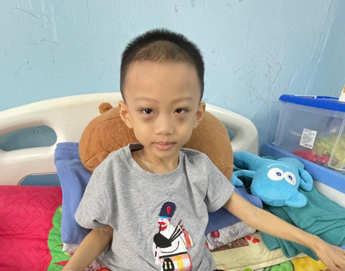 Bé Quân điều trị tại viện. Ảnh: Gia đình cung cấp