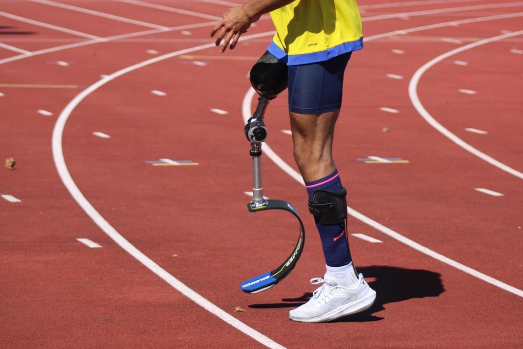 Cầu thủ bóng đá phải cắt chân vì căn bệnh hiểm dễ gây tử vong trong 24 giờ - 2