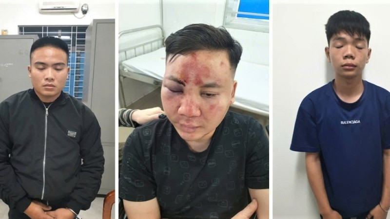 Vụ “ô tô điên” lao vào đám đông ở Nghệ An trong buổi khai trương quán bún ốc: Có dấu hiệu của nhiều tội danh- Ảnh 1.