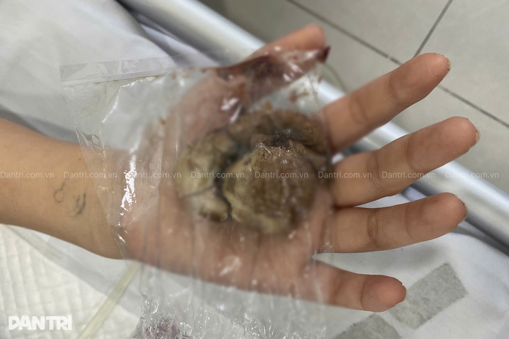 Cô gái nguy kịch, đau đớn sau khi thoát khỏi khu Tam Thái Tử ở Campuchia - 1