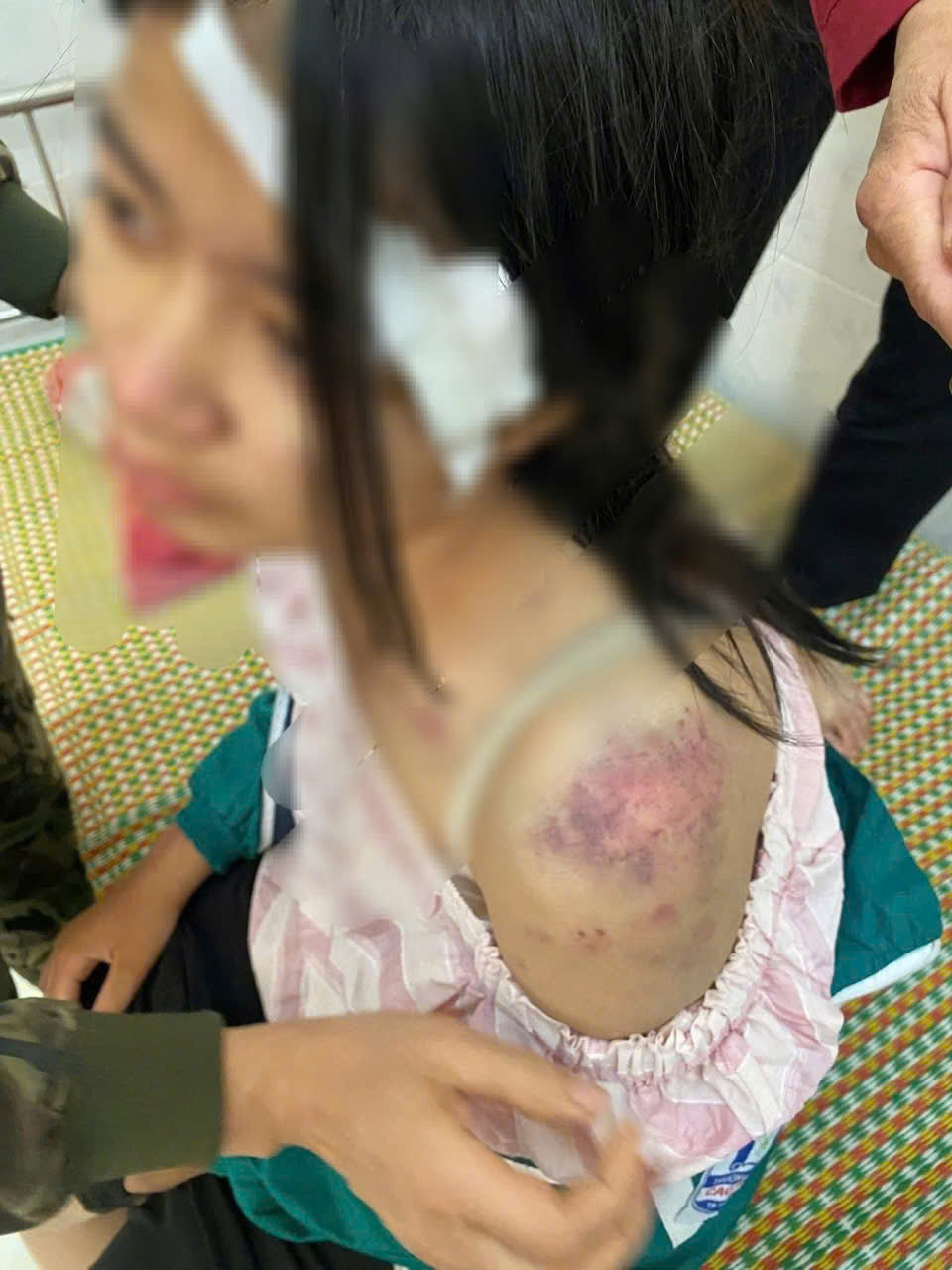 Cục Bà mẹ và Trẻ em chỉ đạo điều trị tâm lý cho bé gái bị 3 người thân bạo hành 1 BẠO HÀNH - Ảnh 1.