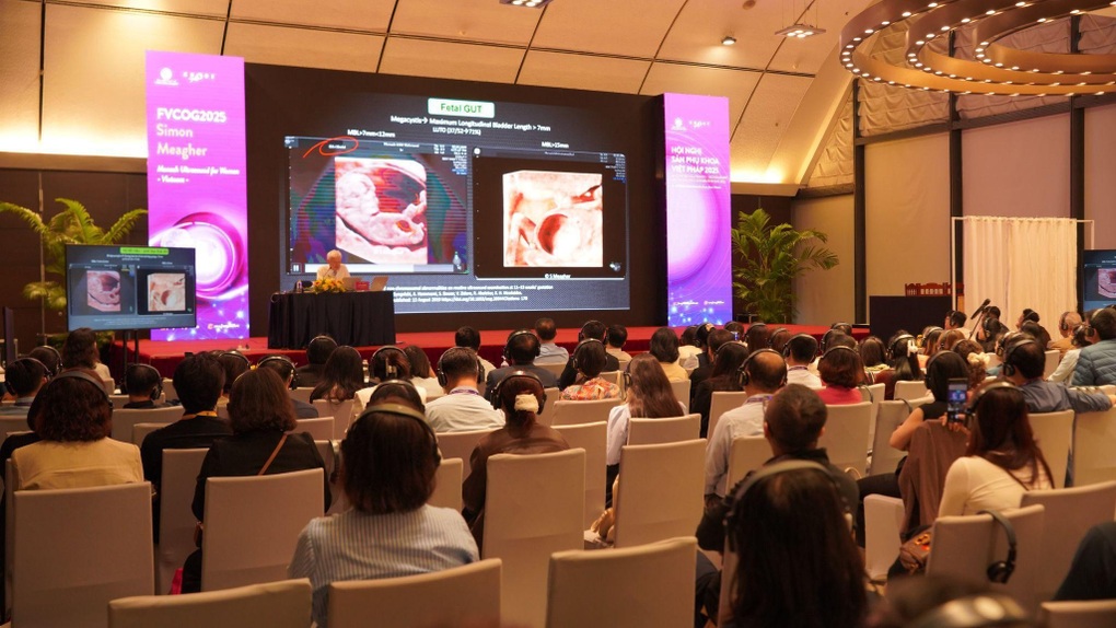 Dạ Hương ra mắt phiên bản mới tại Hội nghị Sản Phụ khoa Việt - Pháp 2025 - 1