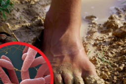 Dọn bùn sau lũ, người đàn ông nhiễm vi khuẩn “ăn thịt người” Whitmore