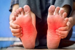 Dấu hiệu ở chân cảnh báo bệnh gan, suy tim và cục máu đông