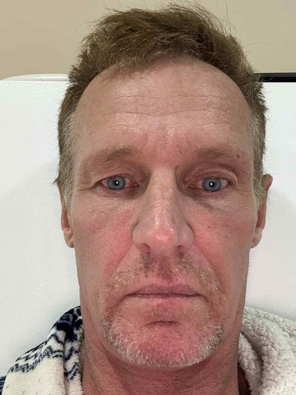 Khách Tây đổi đời sau khi tới Việt Nam phẫu thuật thẩm mỹ - 1