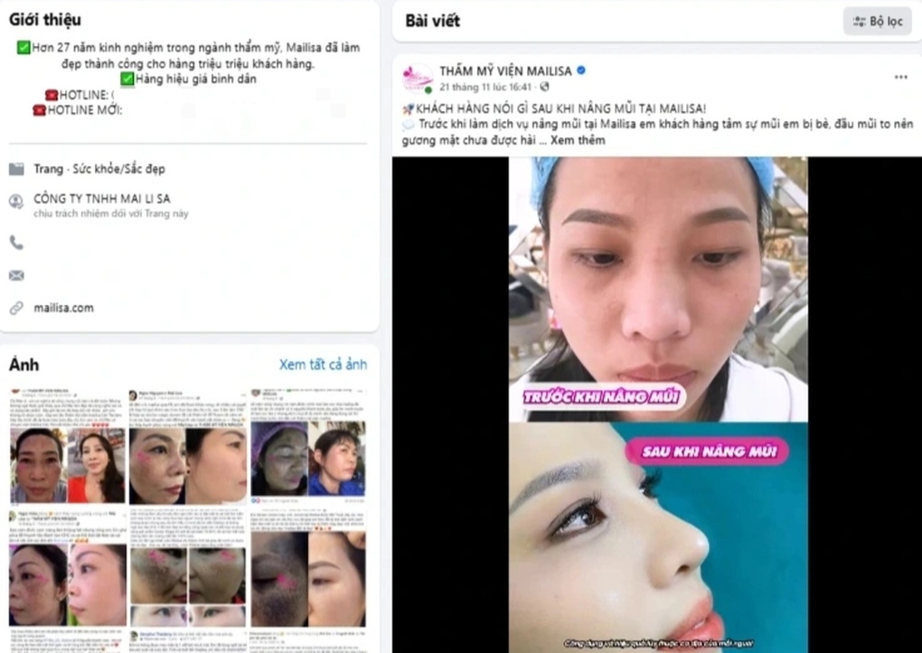 Khách hàng hoang mang, Mailisa bất ngờ dừng bán sản phẩm và dịch vụ - 1
