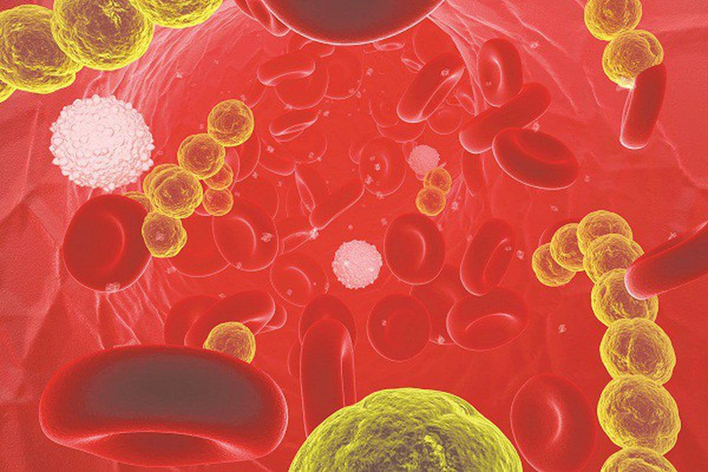 Loại vi khuẩn làm 1,6 triệu ca tử vong mỗi năm, trẻ nhỏ dễ tổn thương nhất - 2