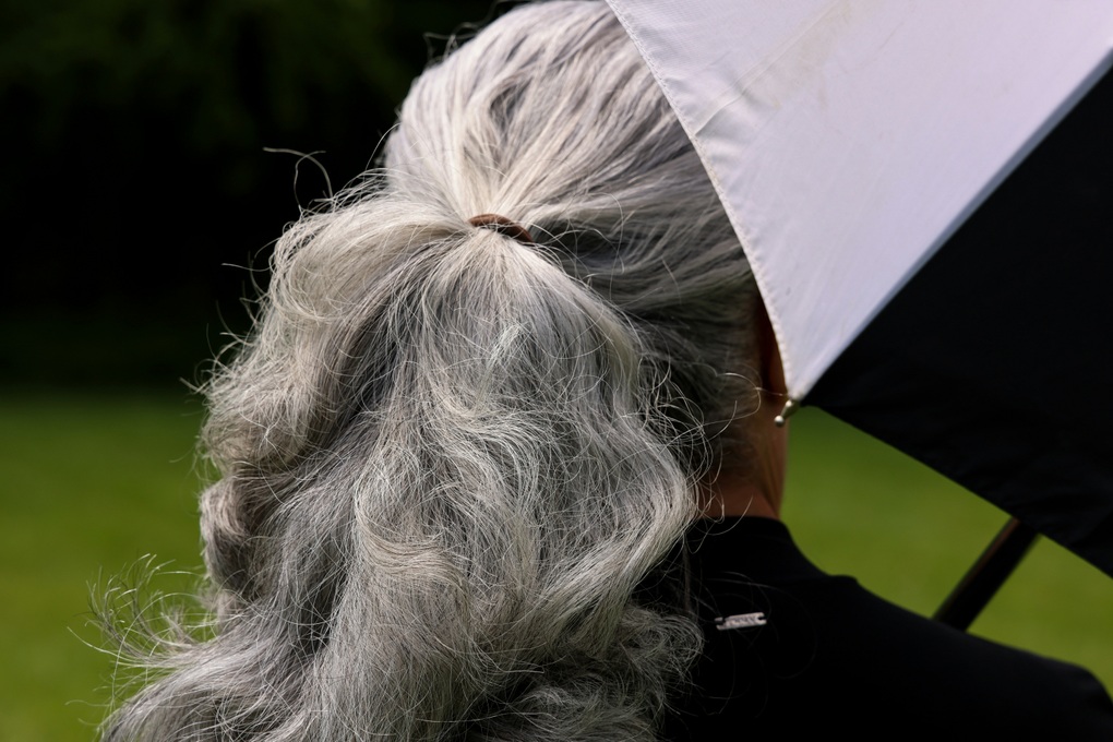 Mái tóc tiết lộ nhiều tình trạng sức khỏe của cơ thể hơn bạn nghĩ - 1