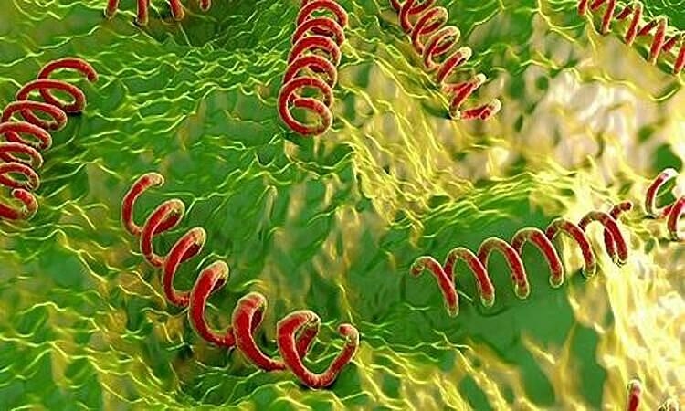 Nguoi dan ong 65 tuoi mac giang mai than kinh