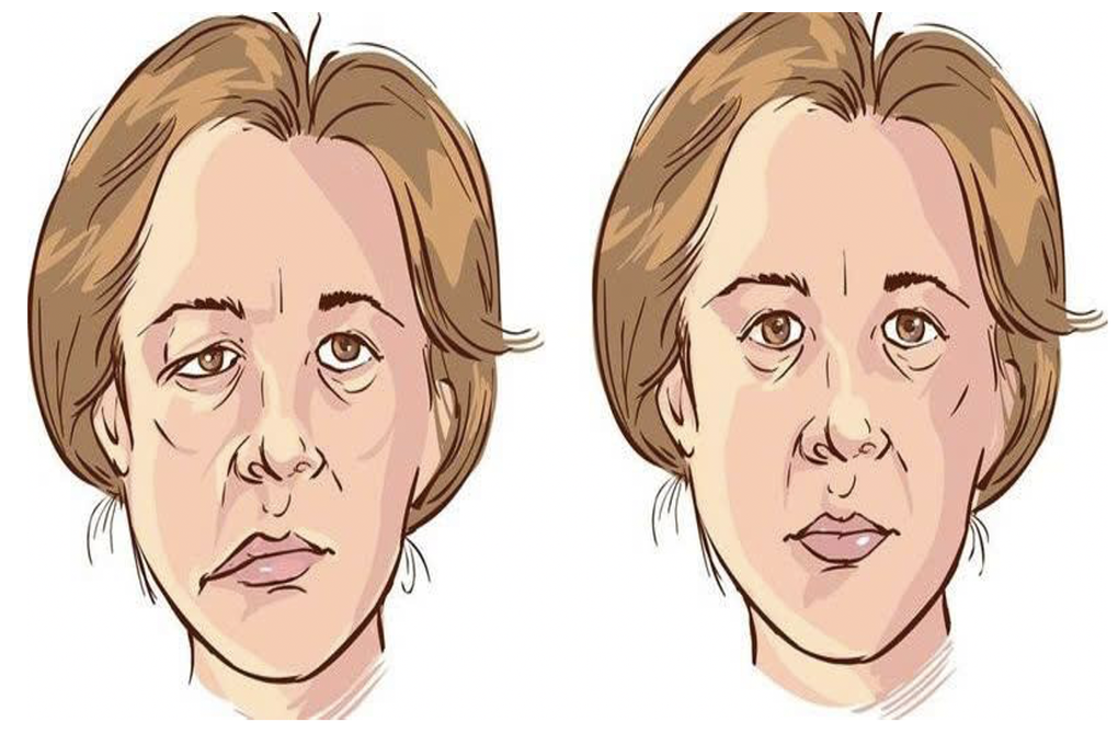 Người phụ nữ mắc căn bệnh nguy hiểm suốt 1 năm nhưng lại tưởng “điềm lành” - 1