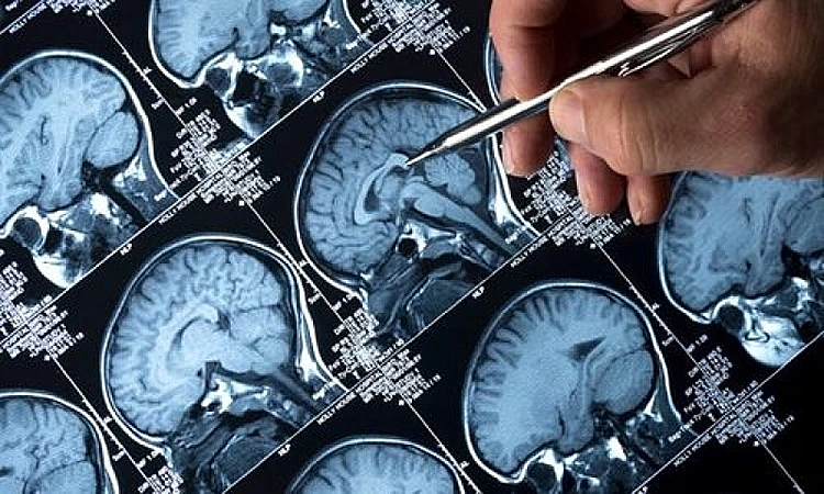 Nhung thoi quen tuong vo hai co the gay dot