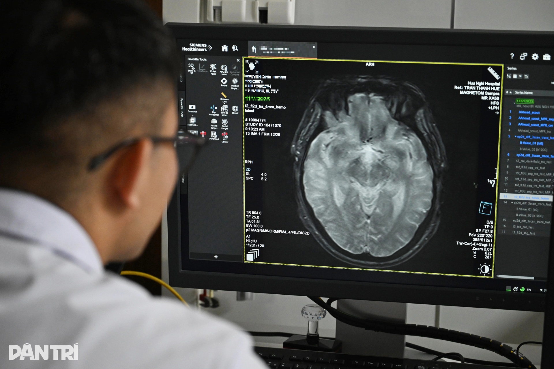 Nín thở xem bác sĩ giải cứu bộ não sắp chết ngạt của bệnh nhân đột quỵ - 2 Nín thở xem bác sĩ giải cứu bộ não sắp chết ngạt của bệnh nhân đột quỵ - 2