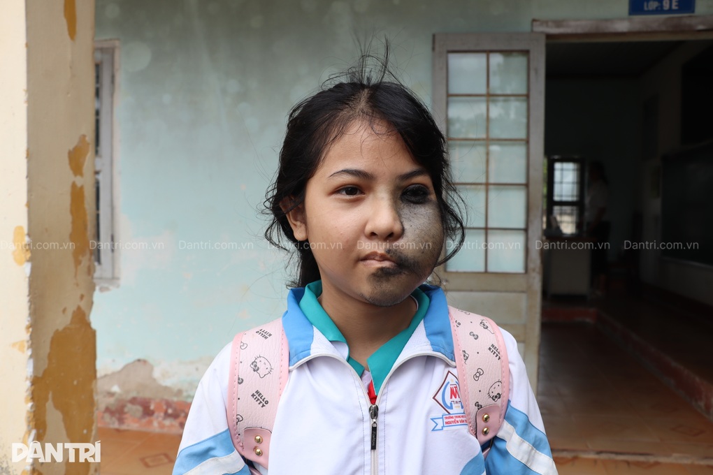 Nỗi đau ẩn phía sau lớp khẩu trang của nữ sinh mồ côi mẹ - 1