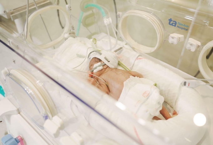 Bé được nuôi dưỡng trong lồng ấp. Ảnh: Bệnh viện Đa khoa Tâm Anh