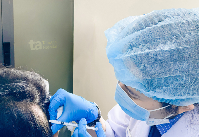 Bác sĩ tiêm hoạt chất triamcinolone điều trị rụng tóc mảng cho anh Tú. Ảnh: Bệnh viện Đa khoa Tâm Anh