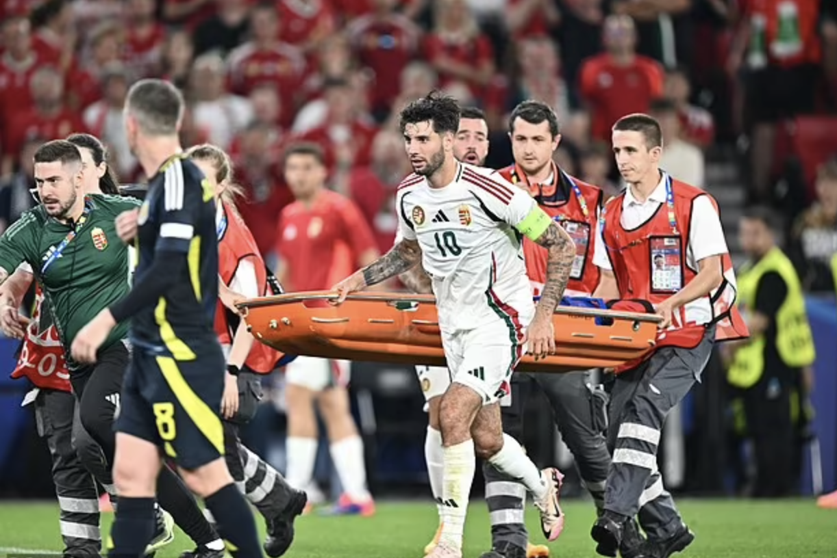 Euro 2024: Sau chấn thương kinh hoàng ở mặt, tuyển thủ Hungary giờ ra sao?- Ảnh 3.