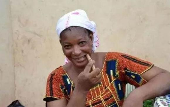 người châu phi, răng trắng, vệ sinh răng, men răng