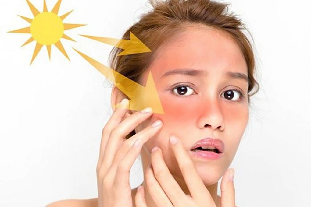 Thu hồi kem chống nắng kém chất lượng, chỉ số chống nắng có như không - 1