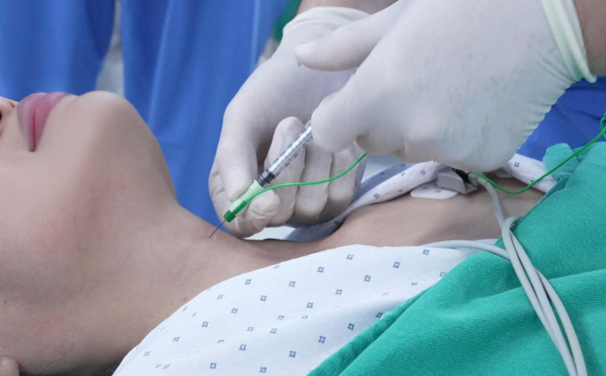 Bác sĩ thực hiện tiêm botulinum toxin cho bệnh nhân. Ảnh: Bệnh viện Đa khoa Tâm Anh