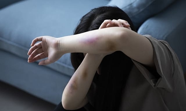 Tranh cai co toi hay khong khi khien ban gai