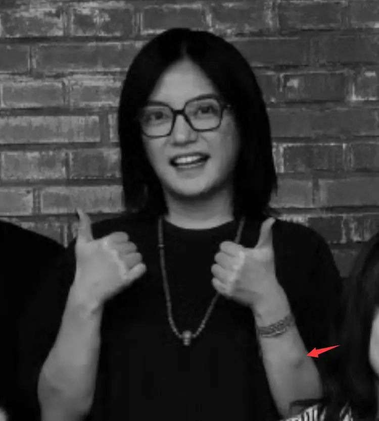 Chuyện gì đang xảy ra với Triệu Vy: Mắc ung thư giai đoạn cuối, đang nguy kịch trong viện?- Ảnh 1.