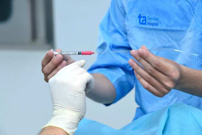 Bác sĩ đang chuẩn bị chuyển phôi cho người bệnh. Ảnh minh họa: IVF Tâm Anh