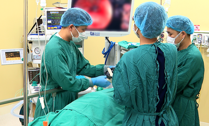 Êkíp thực hiện kỹ thuật Z-Poem cắt vách ngăn giữa túi thừa và lòng thực quản để người bệnh nuốt bình thường. Ảnh: Bệnh viện Đa khoa Tâm Anh