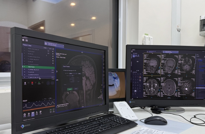 Chụp cộng hưởng từ với chuỗi xung đặc hiệu cho xơ cứng rải rác tại Bệnh viện Quân y 175. Ảnh: Bác sĩ cung cấp