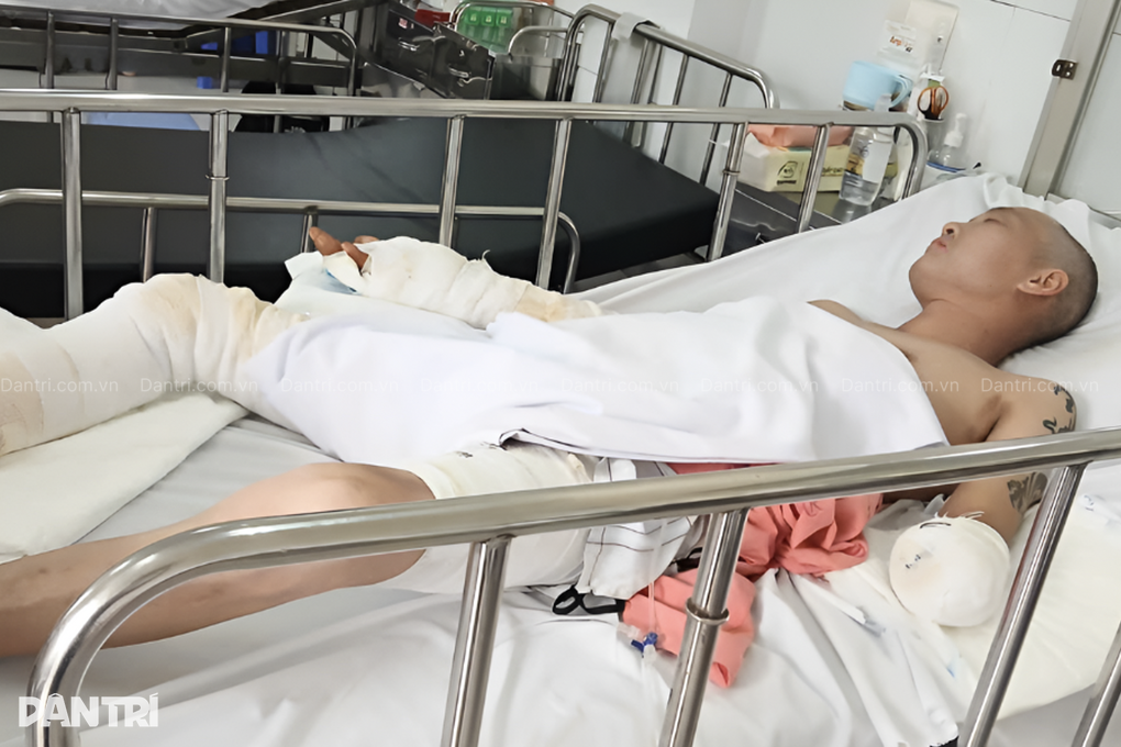 Vợ khóc ngất, đau thắt ruột gan khi chồng bị bỏng điện nguy kịch - 2