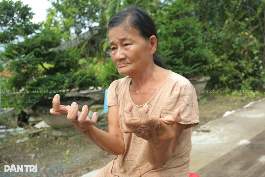 Nhà lá 30 năm bị cuốn sập, người phụ nữ tật nguyền sống nhờ hàng xóm - 3