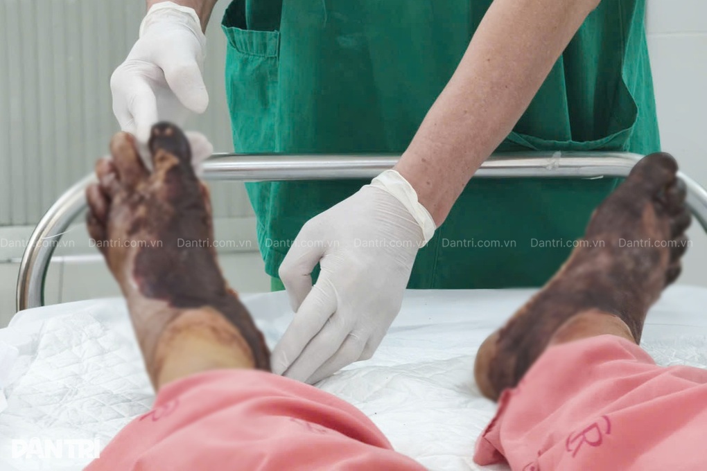 Ngâm nước nóng pha muối để trị tê, nhiều người tiểu đường phải cắt chân - 2