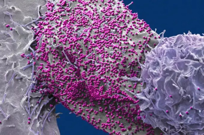 Một tế bào người nhiễm HIV. Ảnh: Steve Gschmeissner/ Science Photo Library
